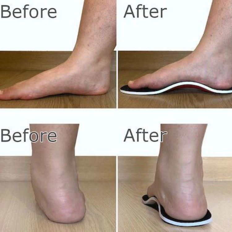Steady Step™ Slim - Arch Support Insoles – Steady Step Insoles